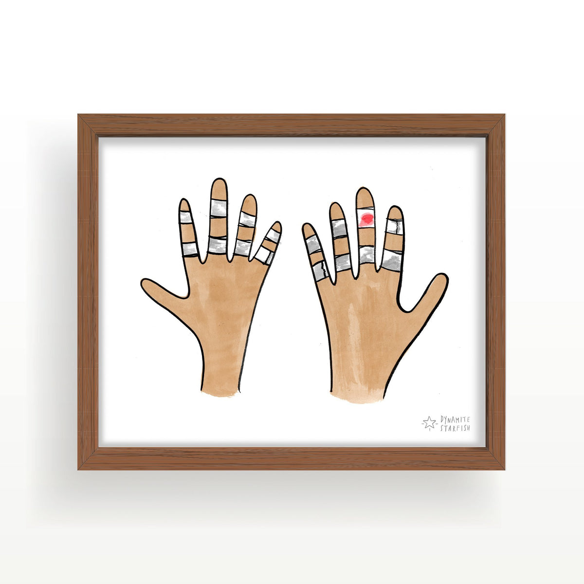 rock climbing t-shirts gifts - Art prints-Taped Hands — 8x10" Art Print - Dynamite Starfish - gift for climber